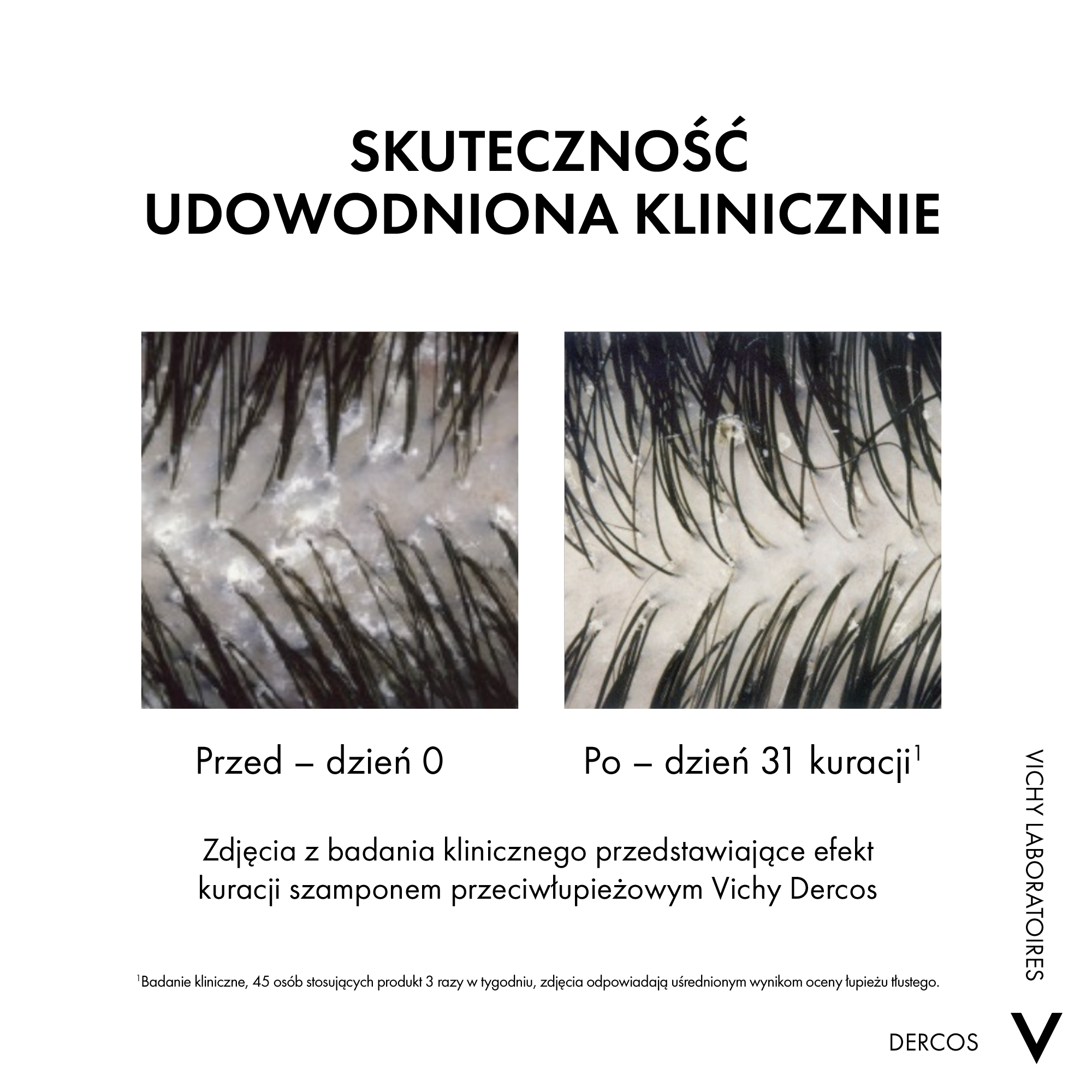 Vichy Dercos DS Szampon przeciwłupieżowy z odżywką 2w1 390 ml
