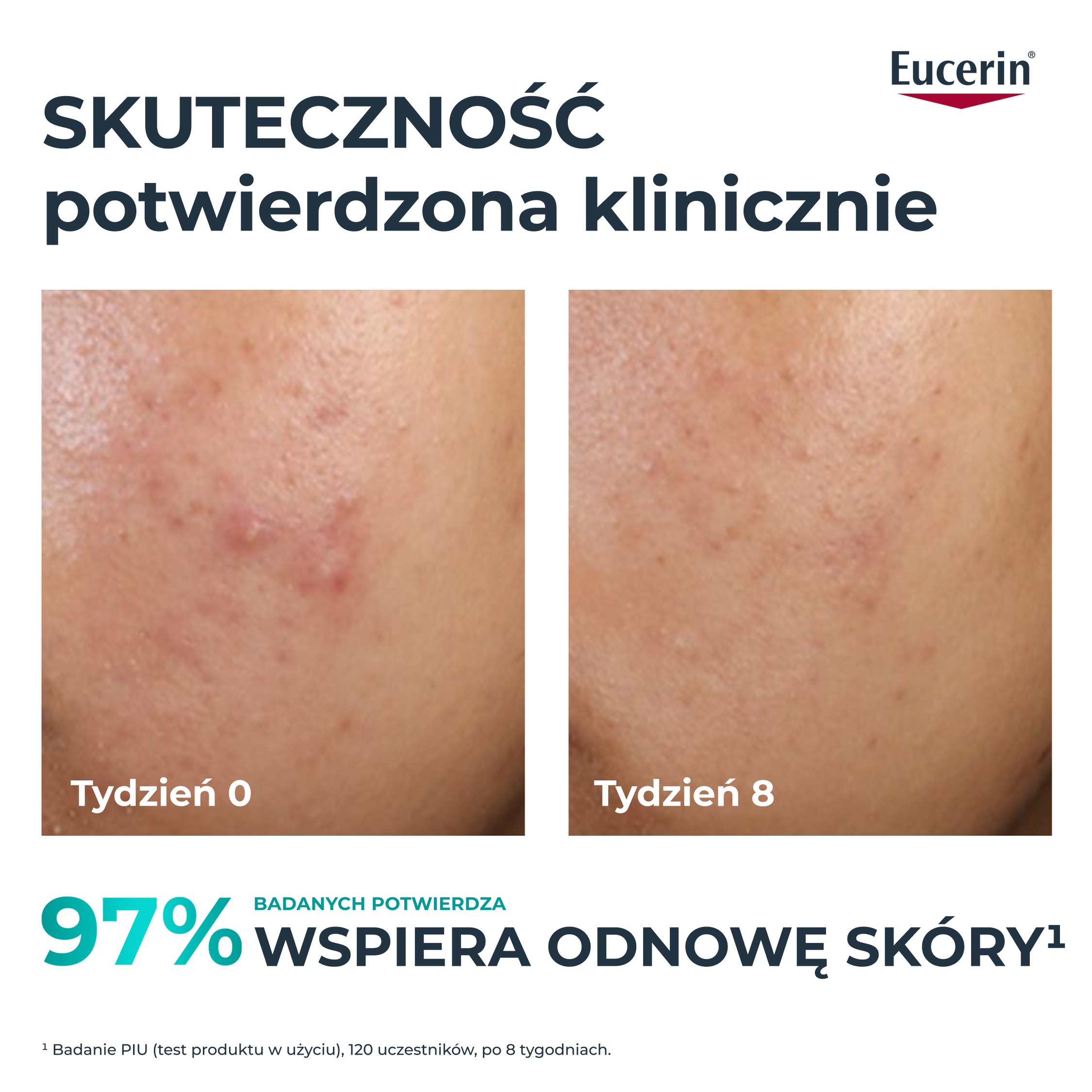 Eucerin Dermopure Clinical, Kuracja złuszczająco-wygładzająca, 40 ml