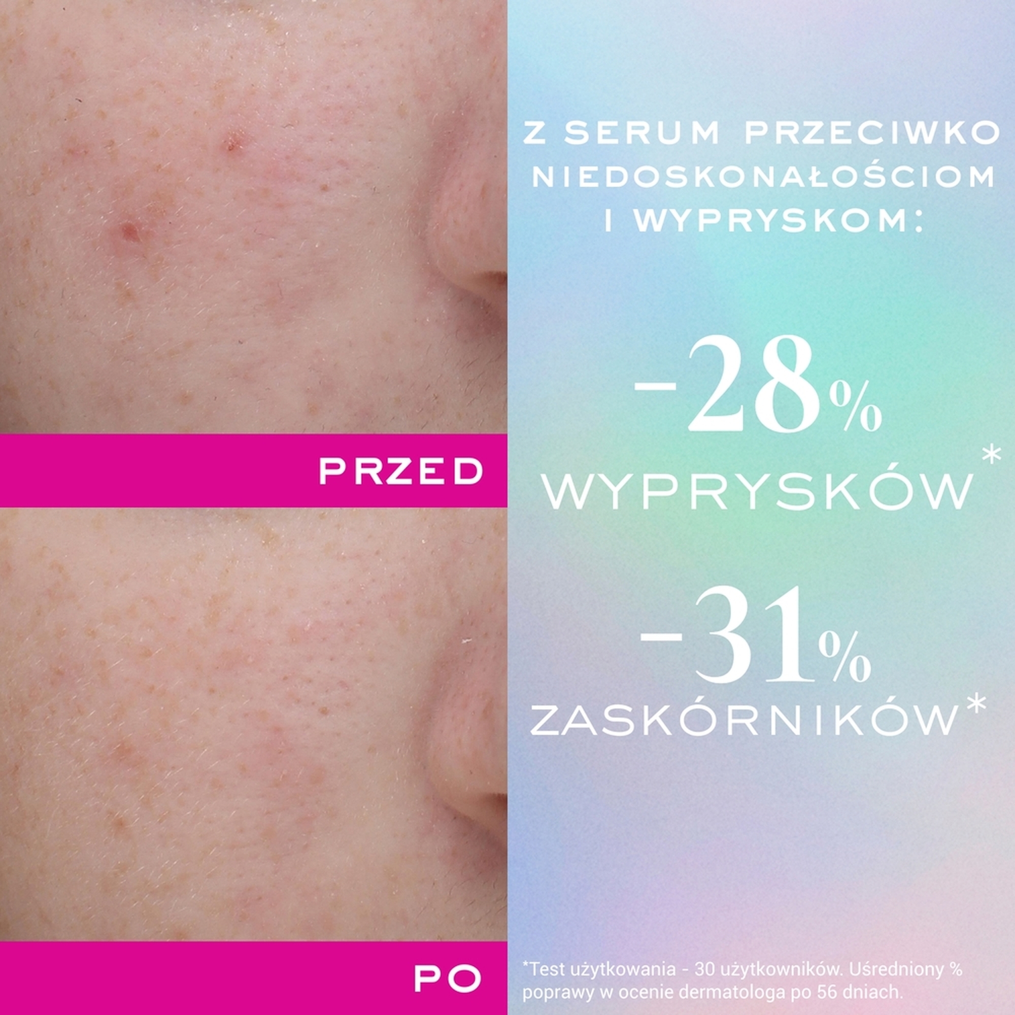 Nuxe Zinc Power, serum przeciw niedoskonałościom i wypryskom, 30 ml