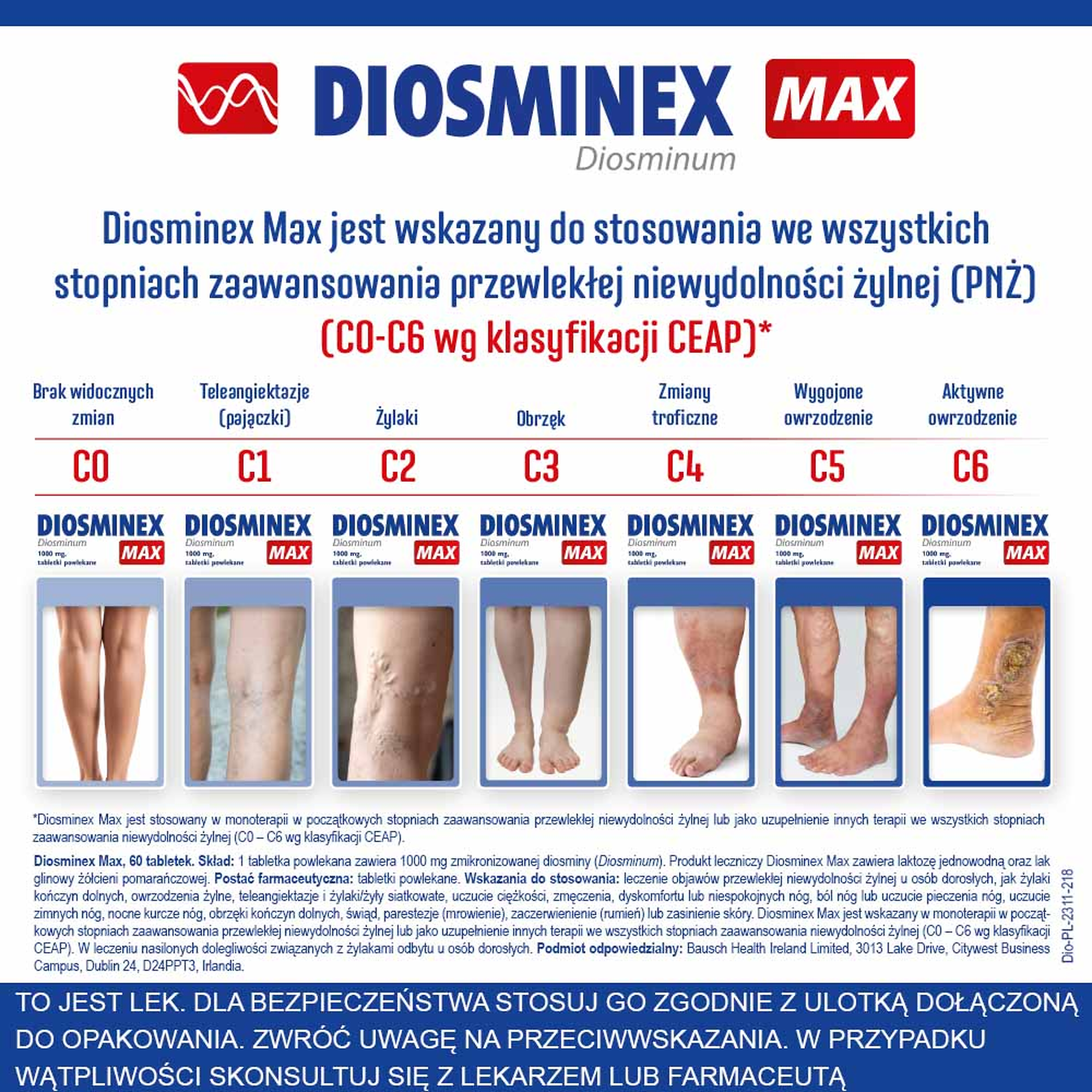 Diosminex Max 1000 mg 60 tabletek