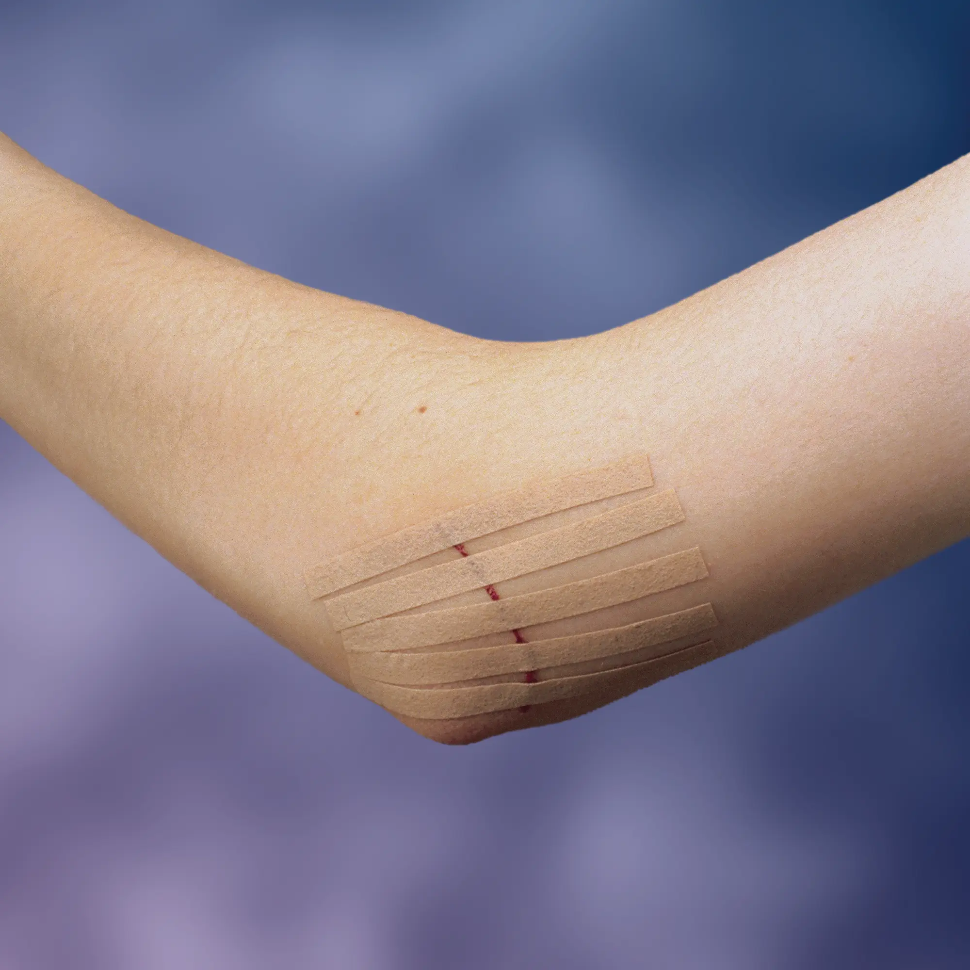 Viscoplast SteriStrip paski do zamykania ran 6 sztuk