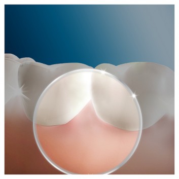 Oral - B OxyJet Dysze do irygatora, 4 szt