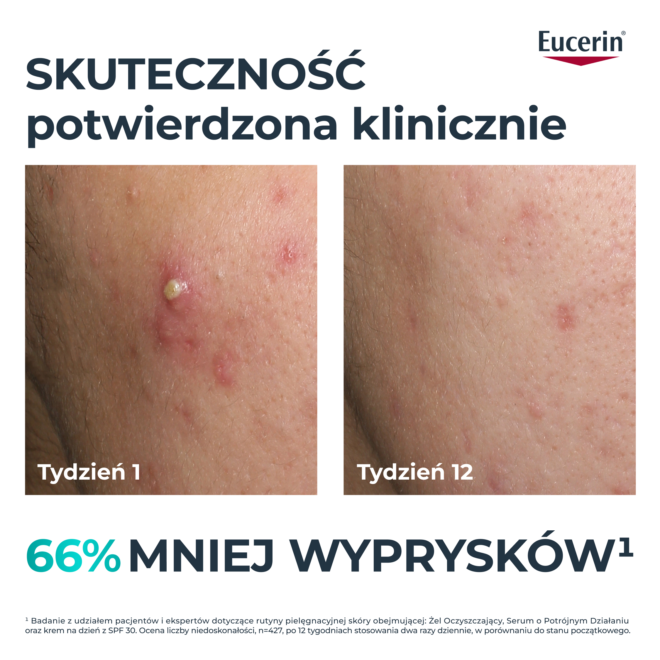 Eucerin Dermopure Clinical, Serum o potrójnym działaniu, 40 ml
