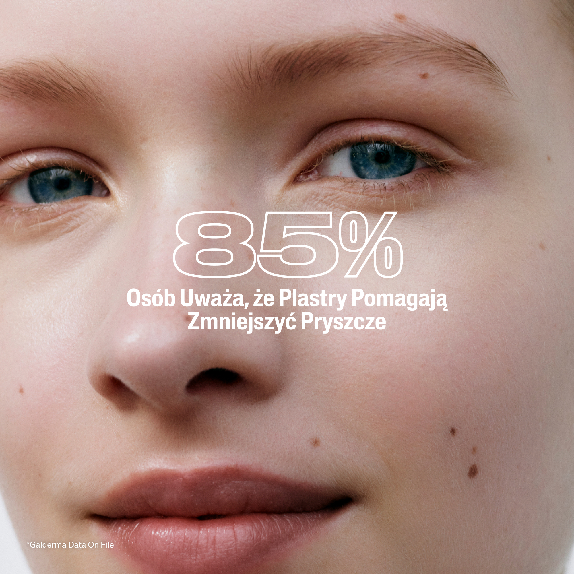 Cetaphil Patches, plasterki na wypryski, plastry, 24 sztuki