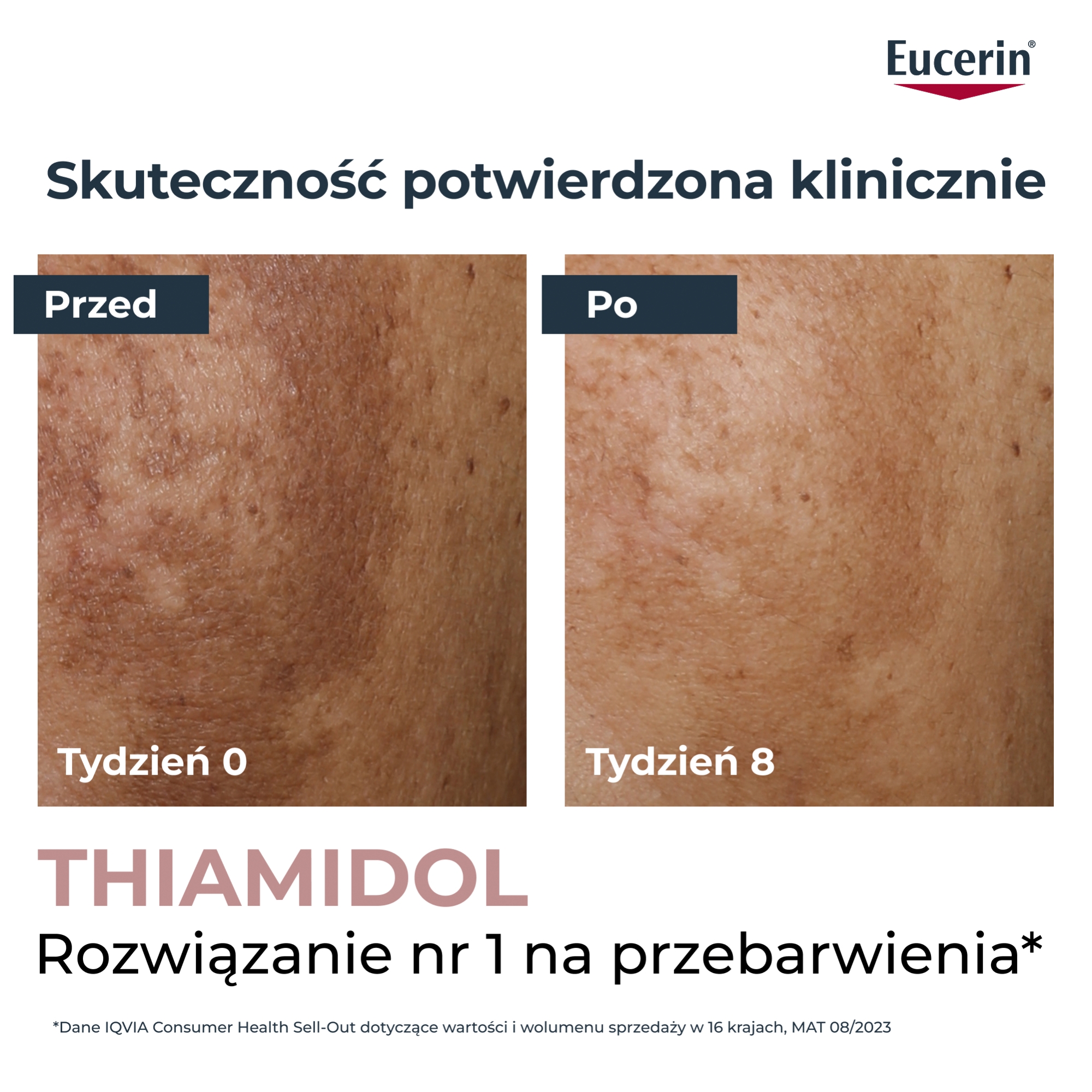 Eucerin Anti-Pigment Korektor punktowy z Thiamidolem przeciw przebarwieniom, 5 ml