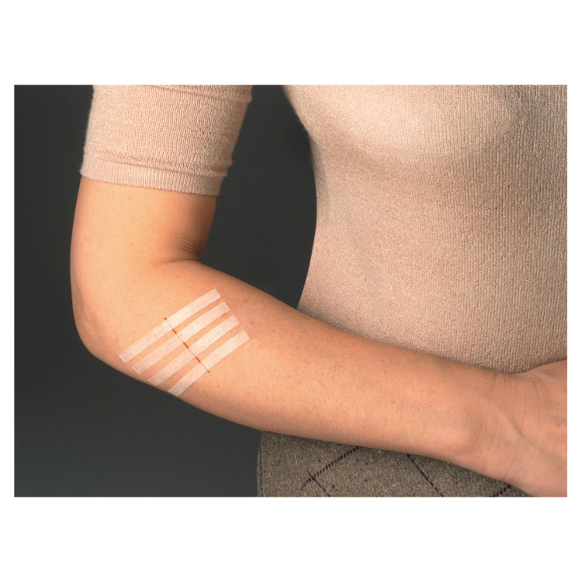 Viscoplast SteriStrip paski do zamykania ran 8 sztuk