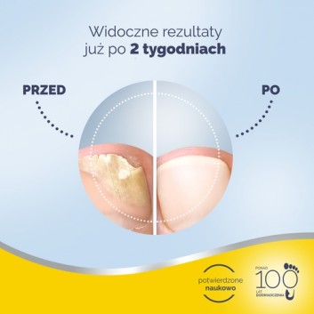 Scholl, preparat na grzybicę paznokci, 3,8 ml