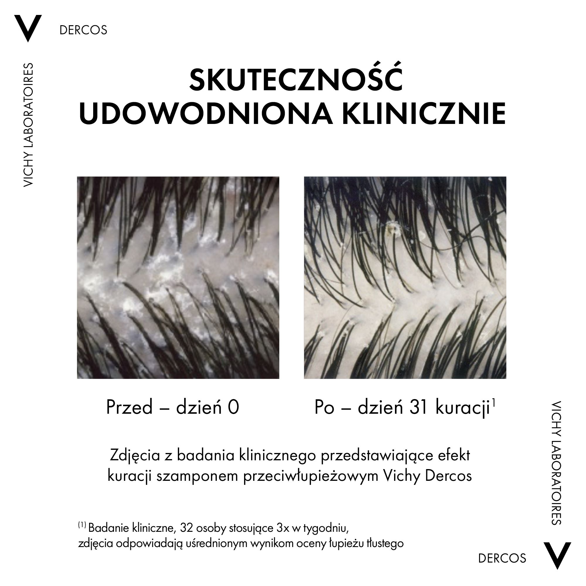 Vichy Dercos szampon przeciwłupieżowy do włosów normalnych i przetłuszczających się 200 ml