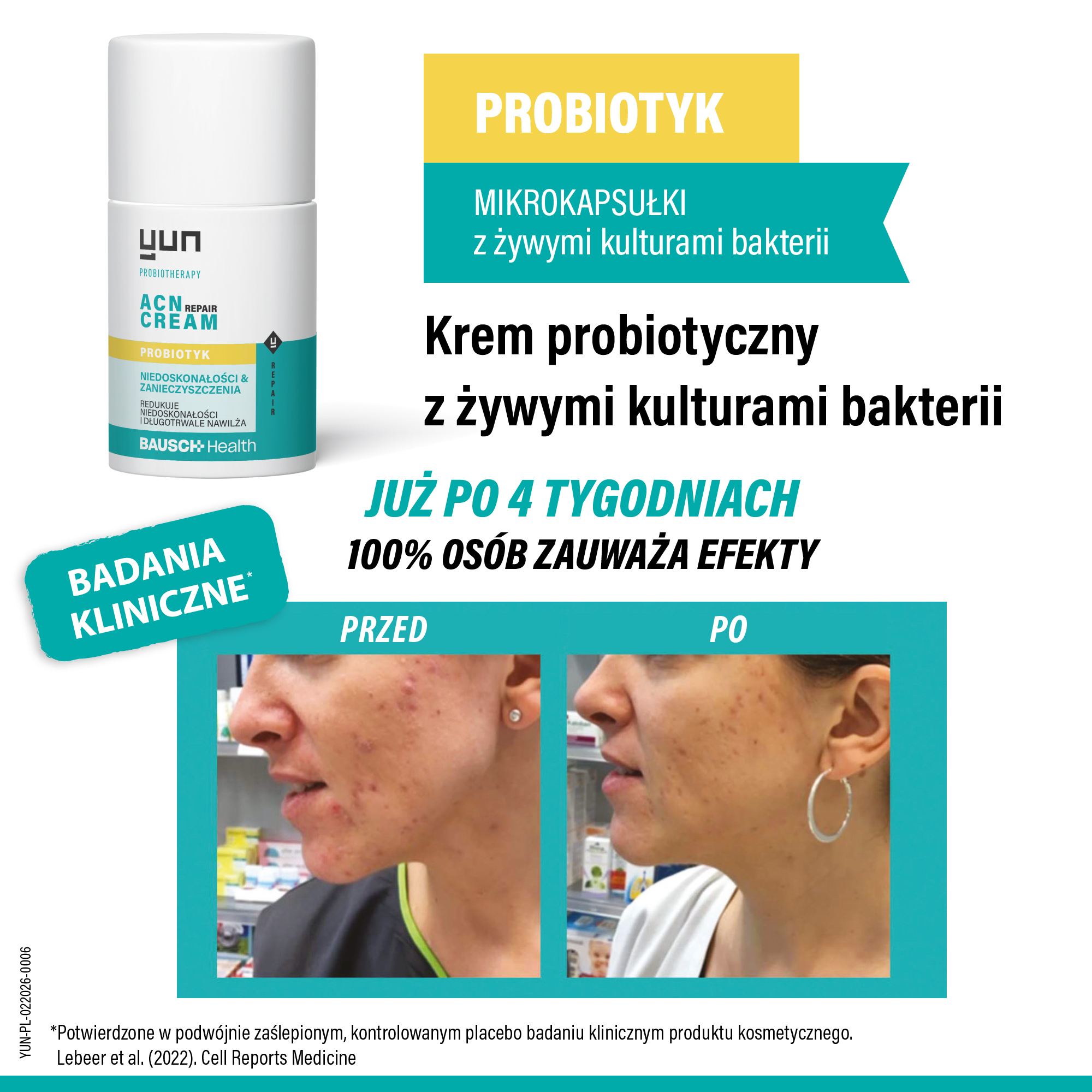 Yun Acn Repair Cream krem probiotyczny do twarzy, 50 ml