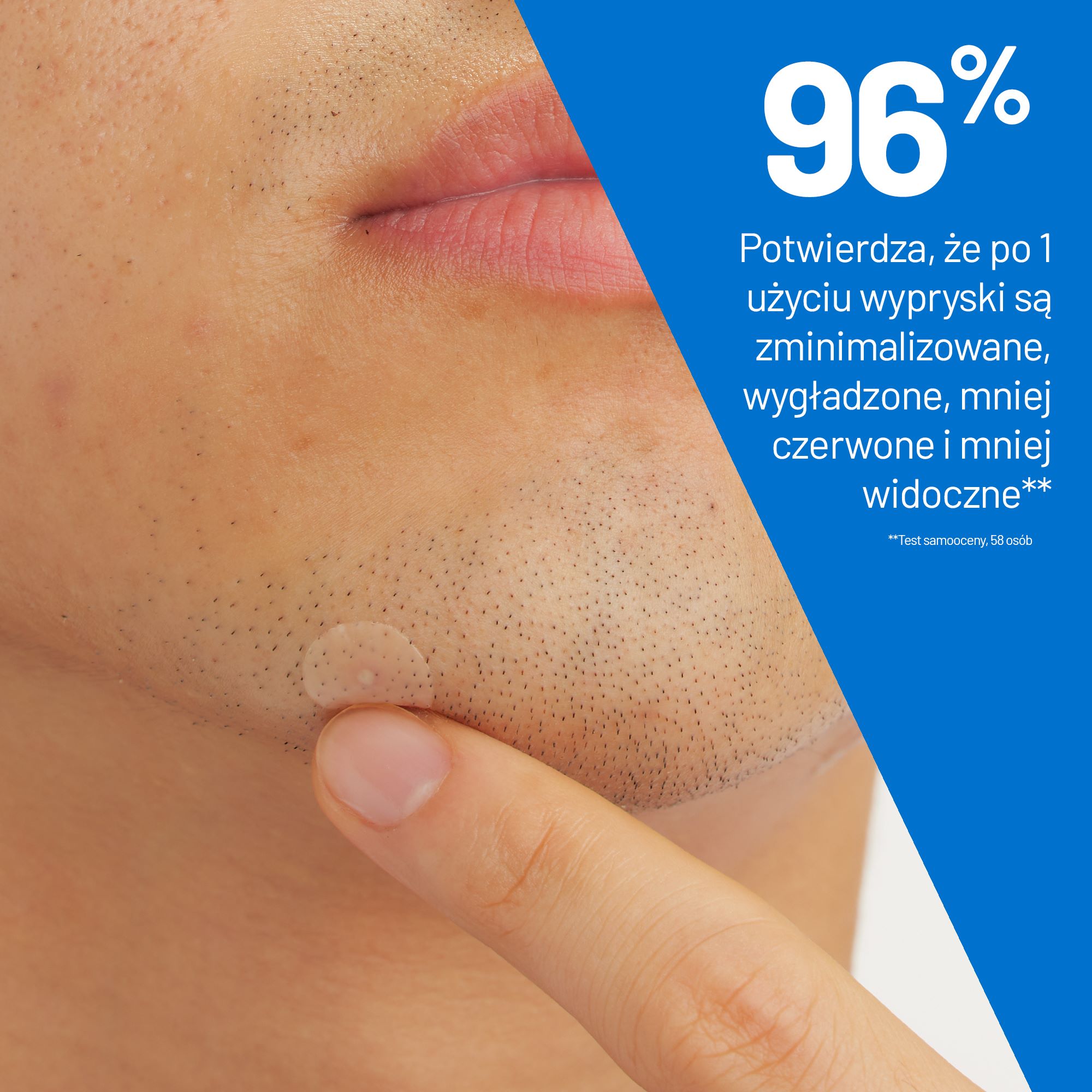 Cerave, punktowe plasterki na wypryski, 22 szt