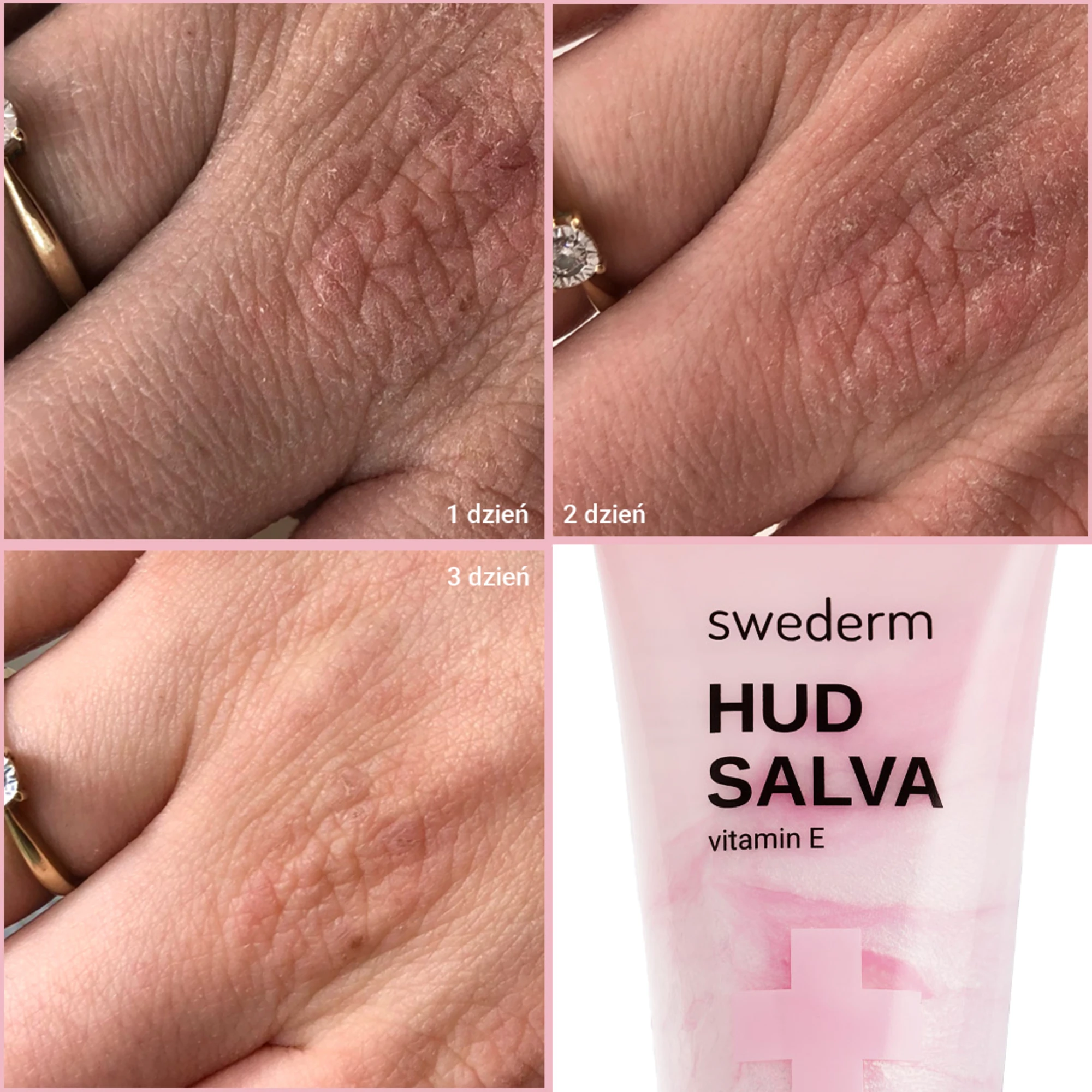 Swederm Hudsalva vit.E maść do skóry suchej i reaktywnej z witaminą E, 50 ml