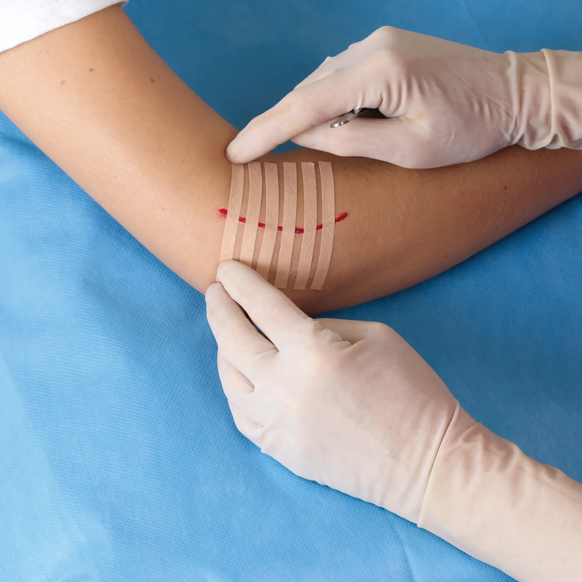 Viscoplast SteriStrip paski do zamykania ran 6 sztuk