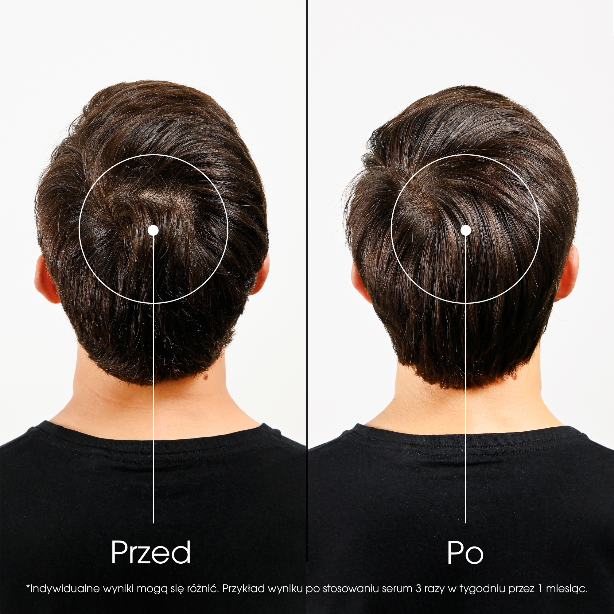 Klorane Przeciw Wypadaniu Włosów Kuracja intensywnie wzmacniająca serum z chininą, 100 ml