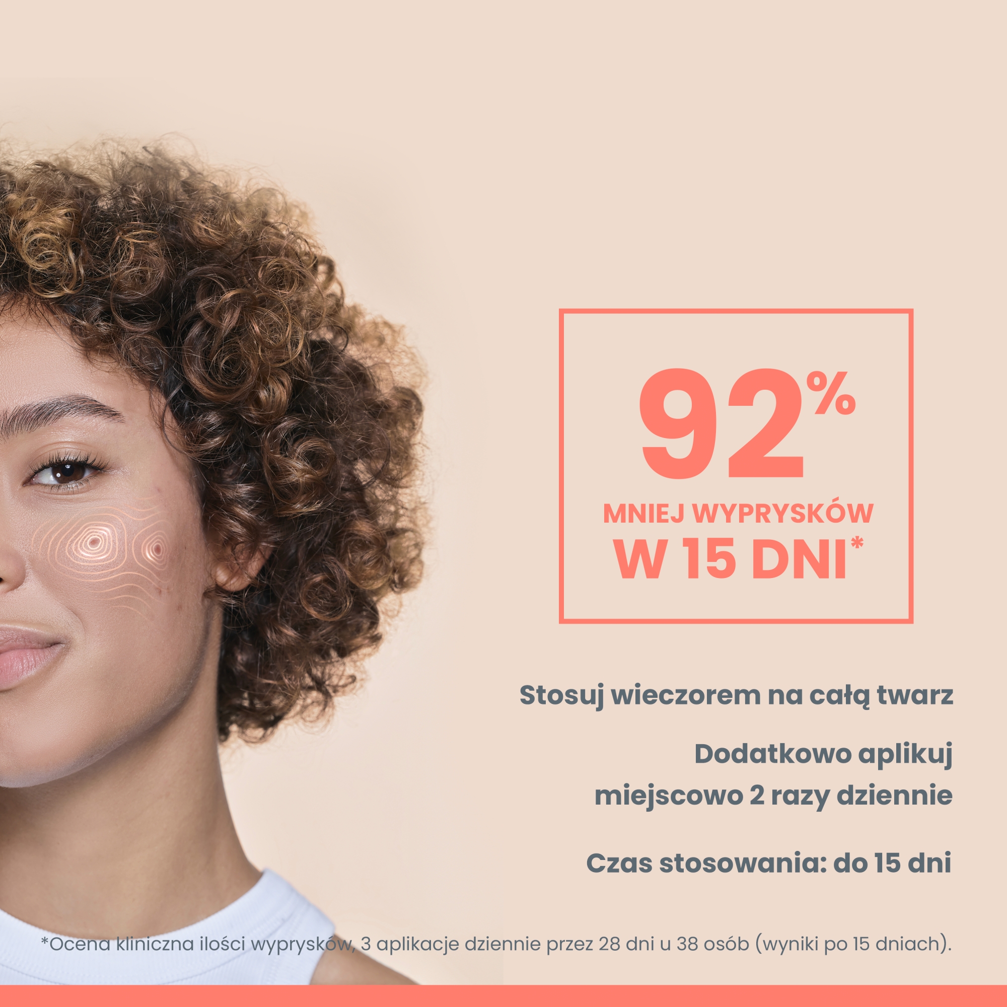 Avene Cleanance Comedomed Peeling, intensywny krem na wypryski, 40 ml