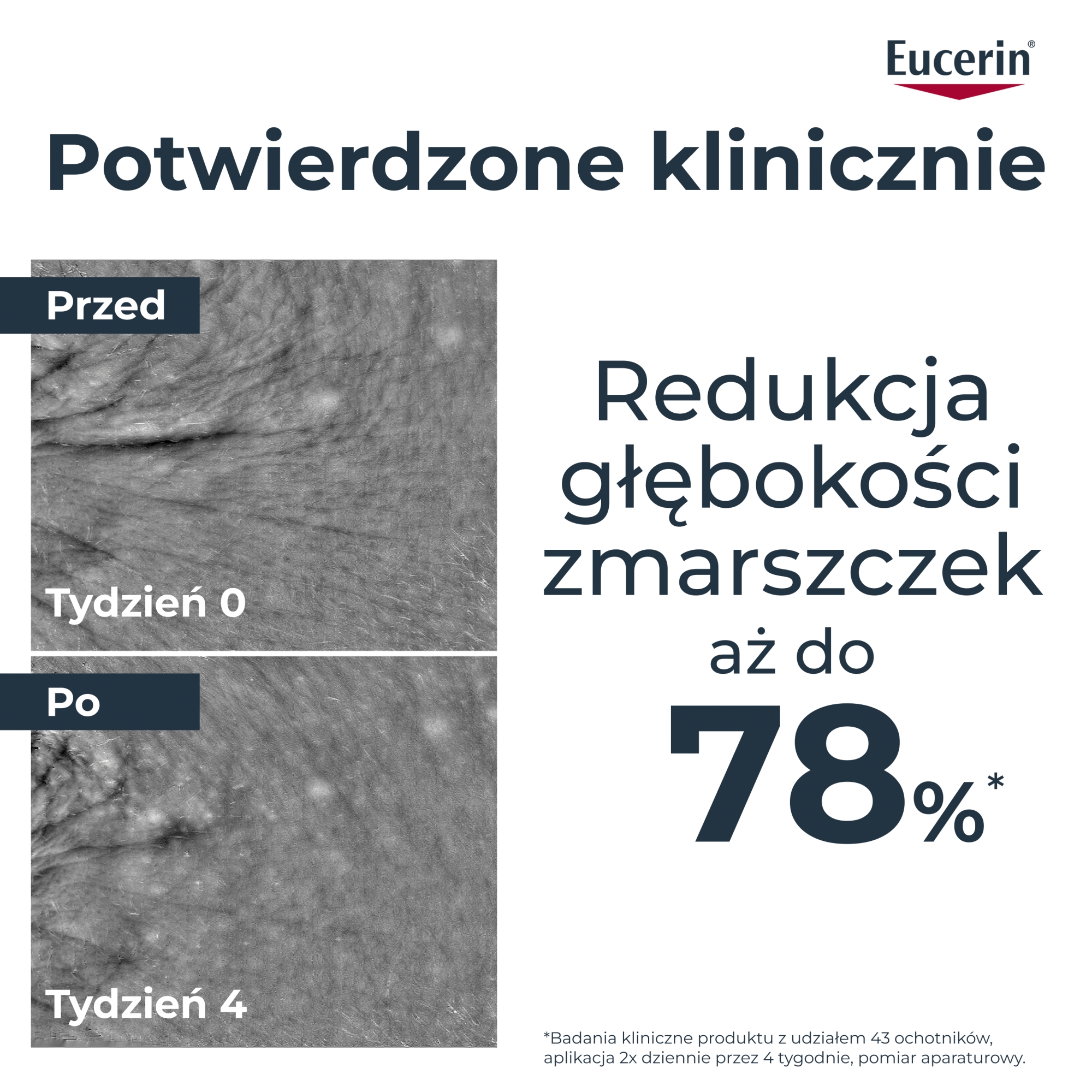 Eucerin Hyaluron-Filler Serum przeciwzmarszczkowe Epigenetic z Epicelline, 30 ml