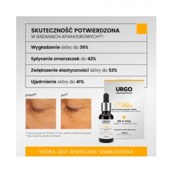 Urgo Dermoestetic C-Vitalize serum rewitalizująco-rozświetlające 21% C-Hyal 30 ml