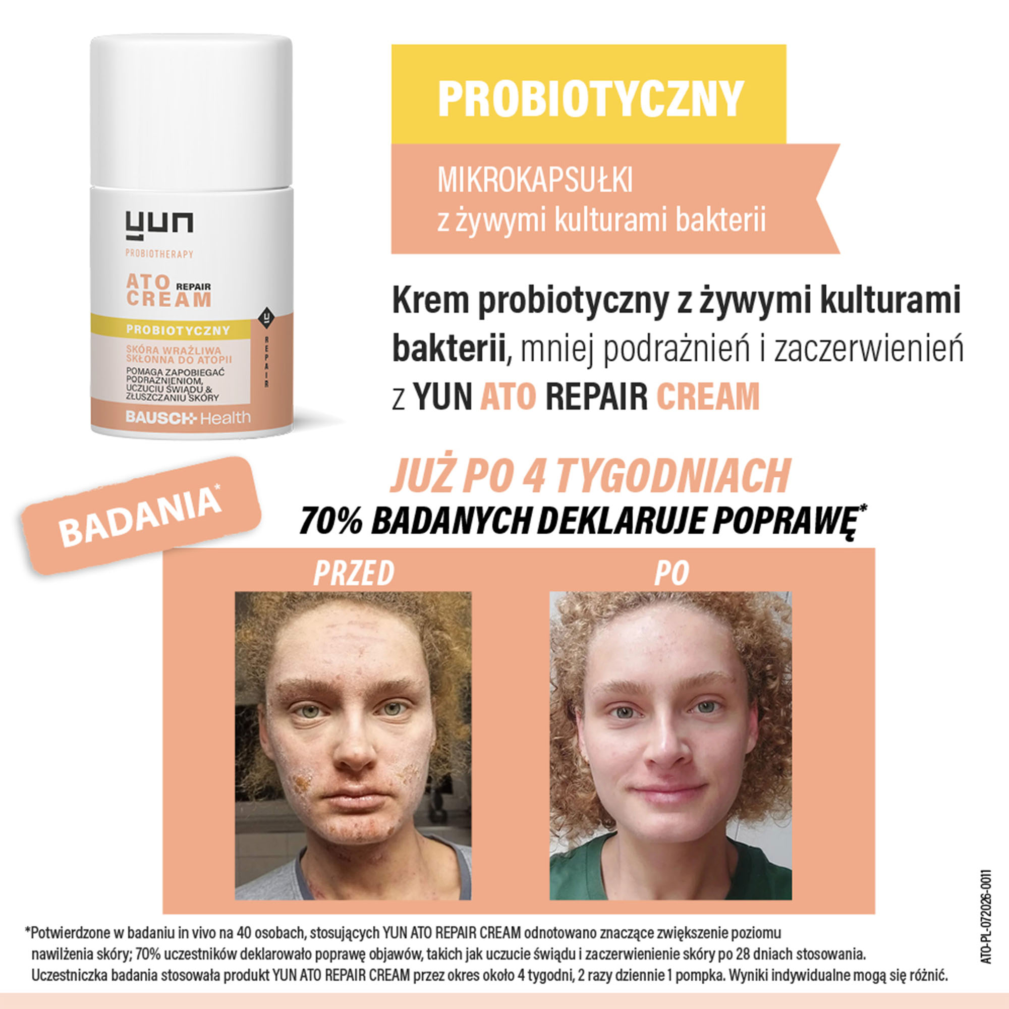 Yun Ato Repair Cream krem probiotyczny, 50 ml