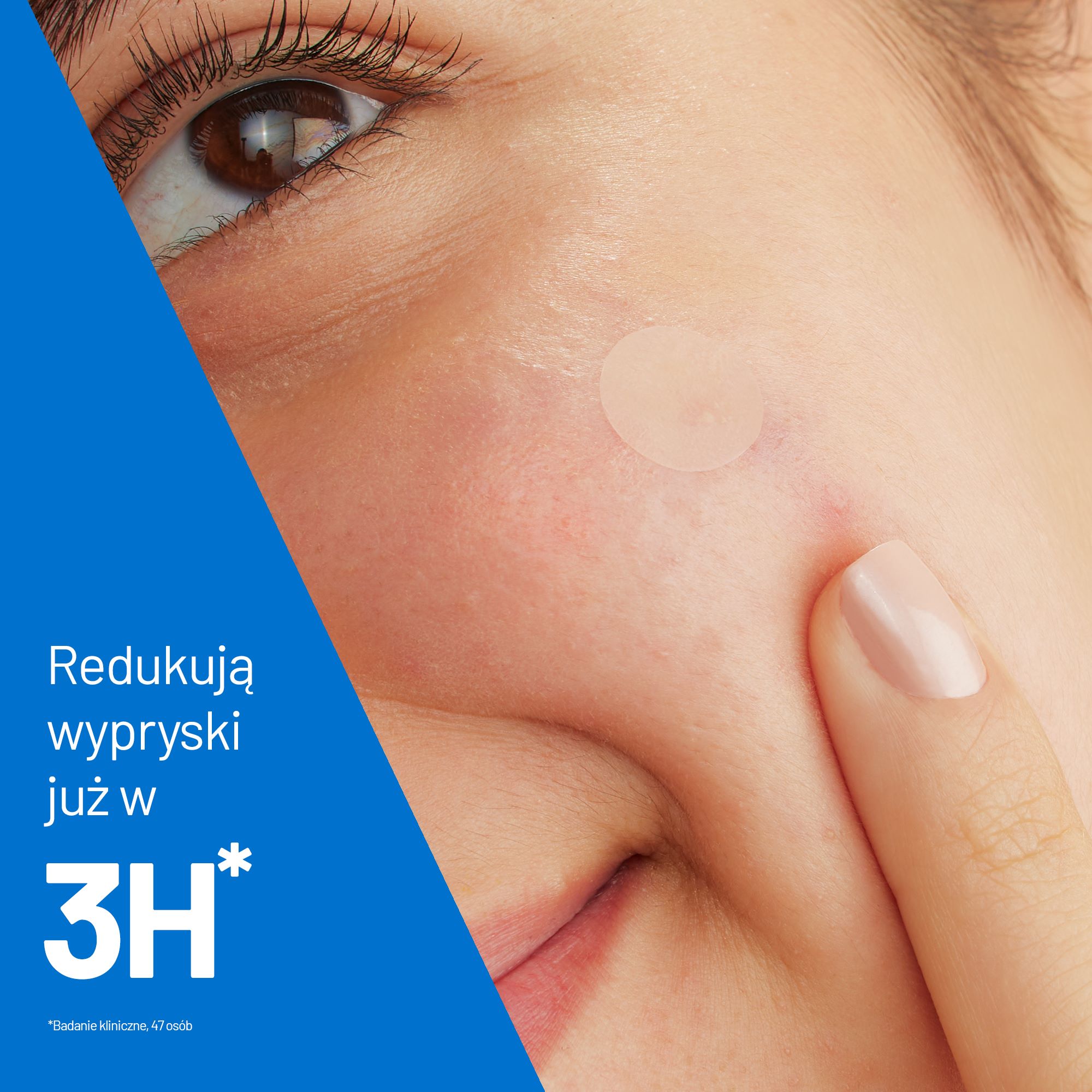 Cerave, punktowe plasterki na wypryski, 22 szt