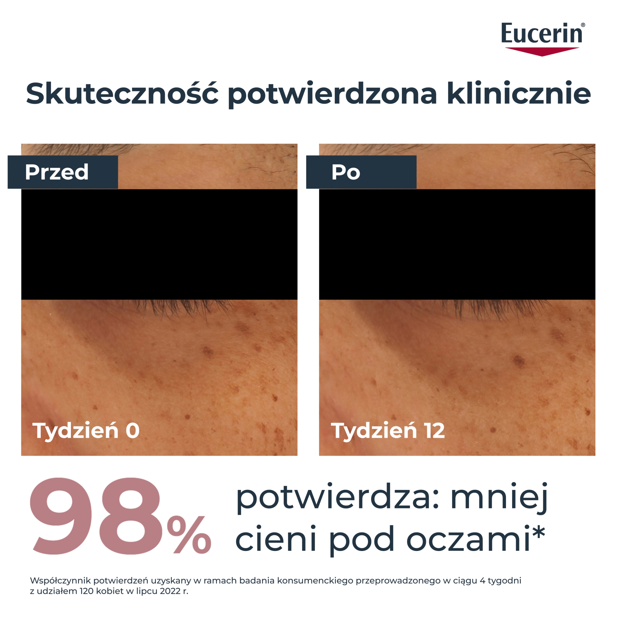 Eucerin Anti-Pigment Krem pod oczy rozjaśniający cienie pod oczami, 15 ml