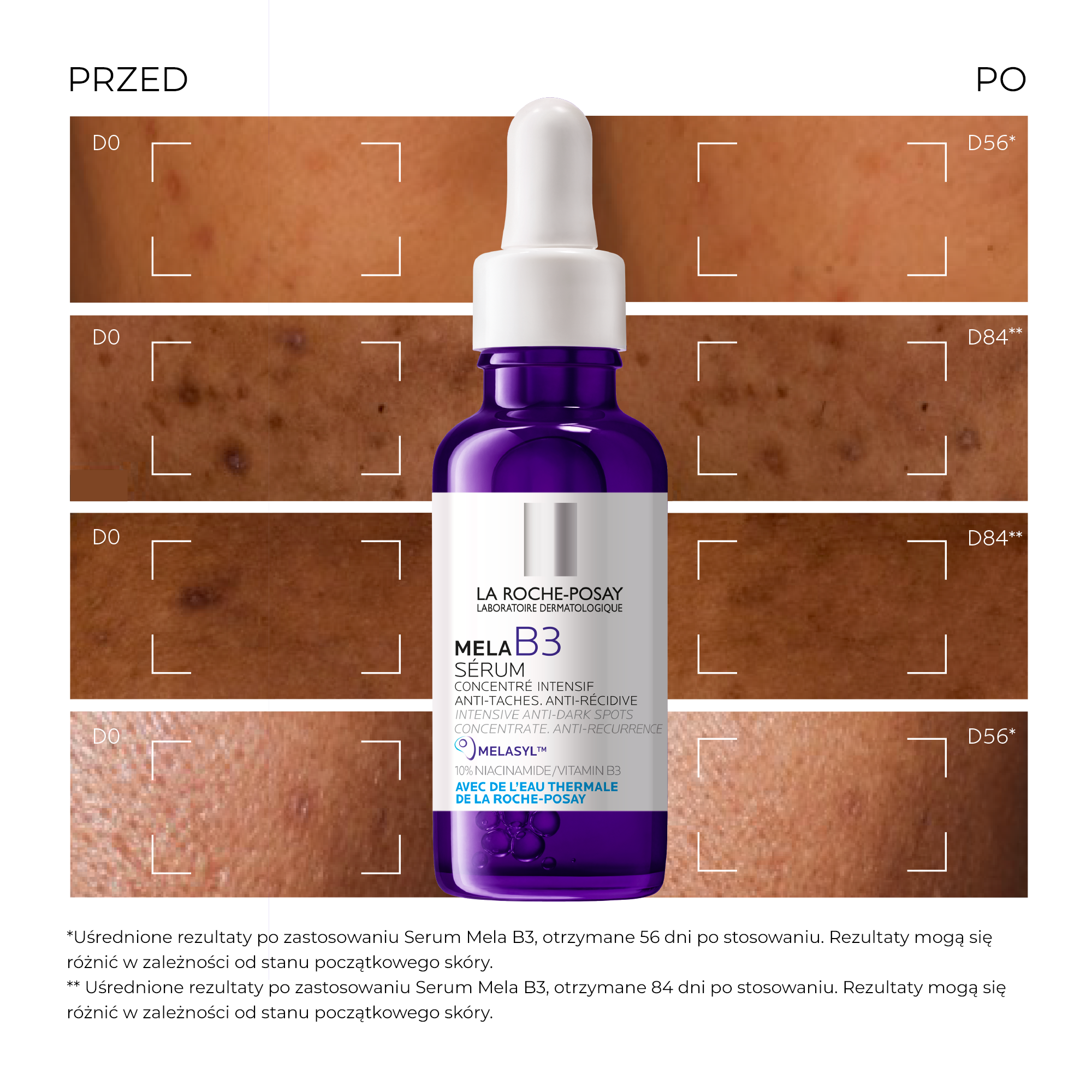 La Roche-Posay Mela B3, skoncentrowane serum przeciw przebarwieniom, 30 ml