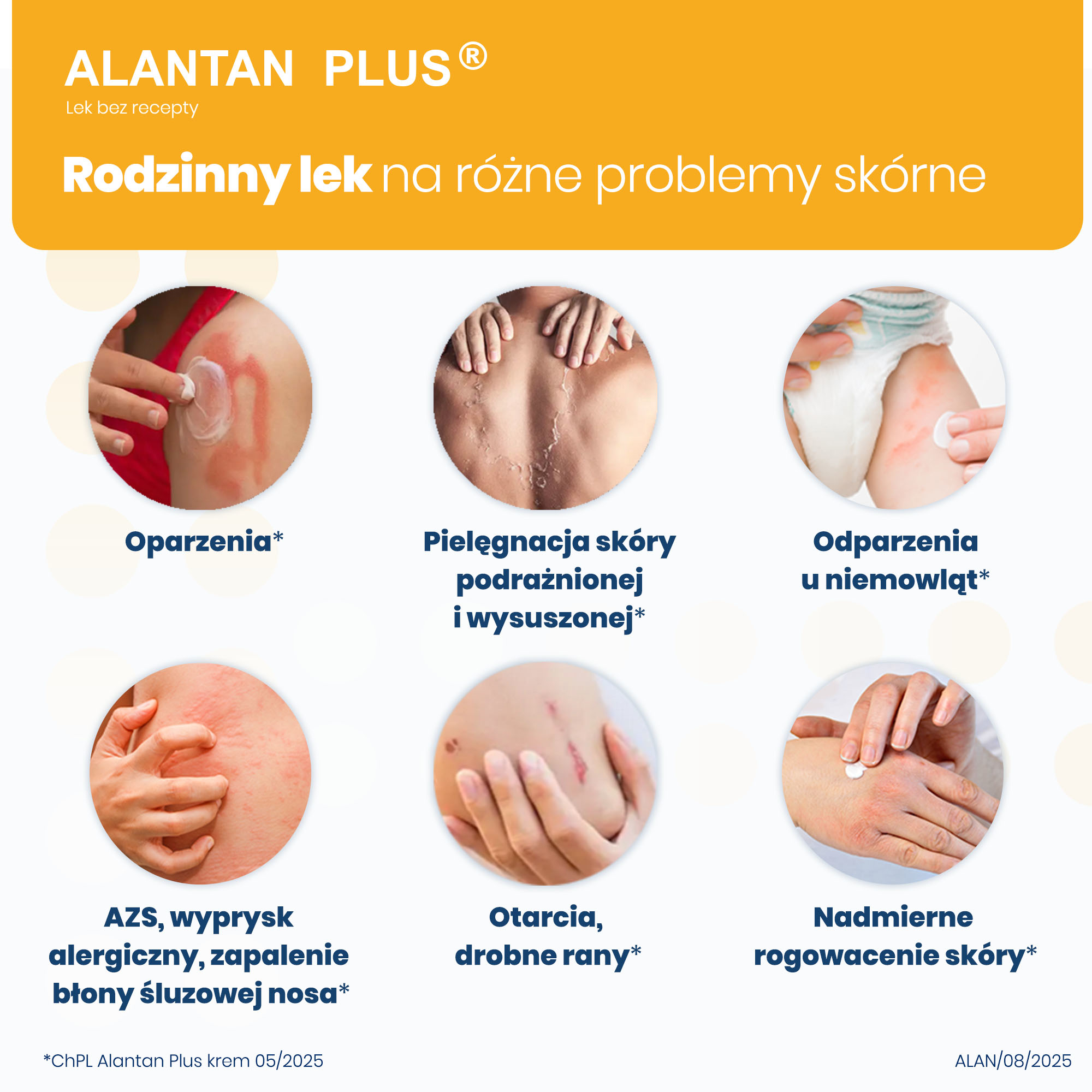 Alantan Plus (20 mg + 50 mg)/g, krem, 35 g