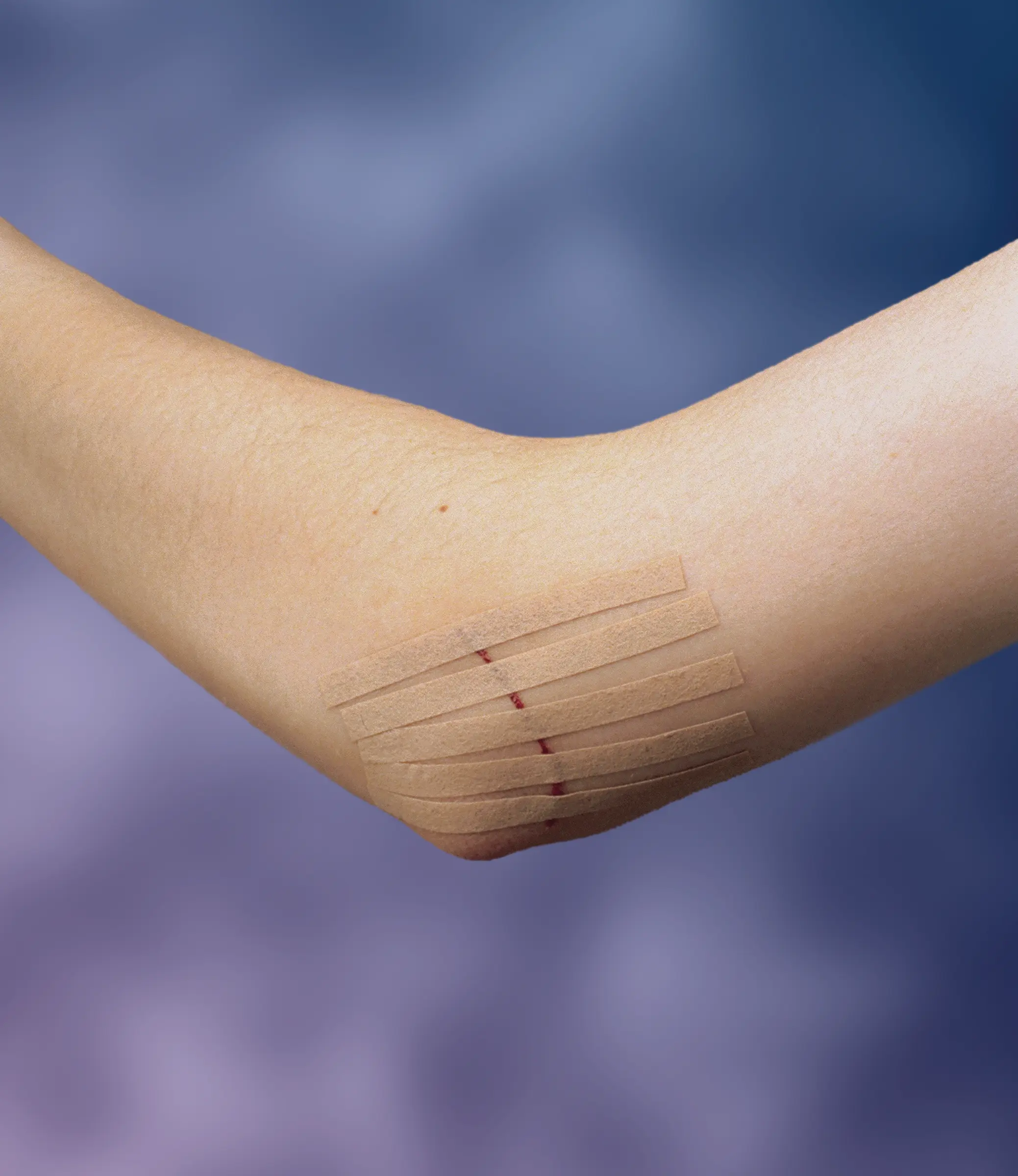 Viscoplast SteriStrip paski do zamykania ran 6 sztuk