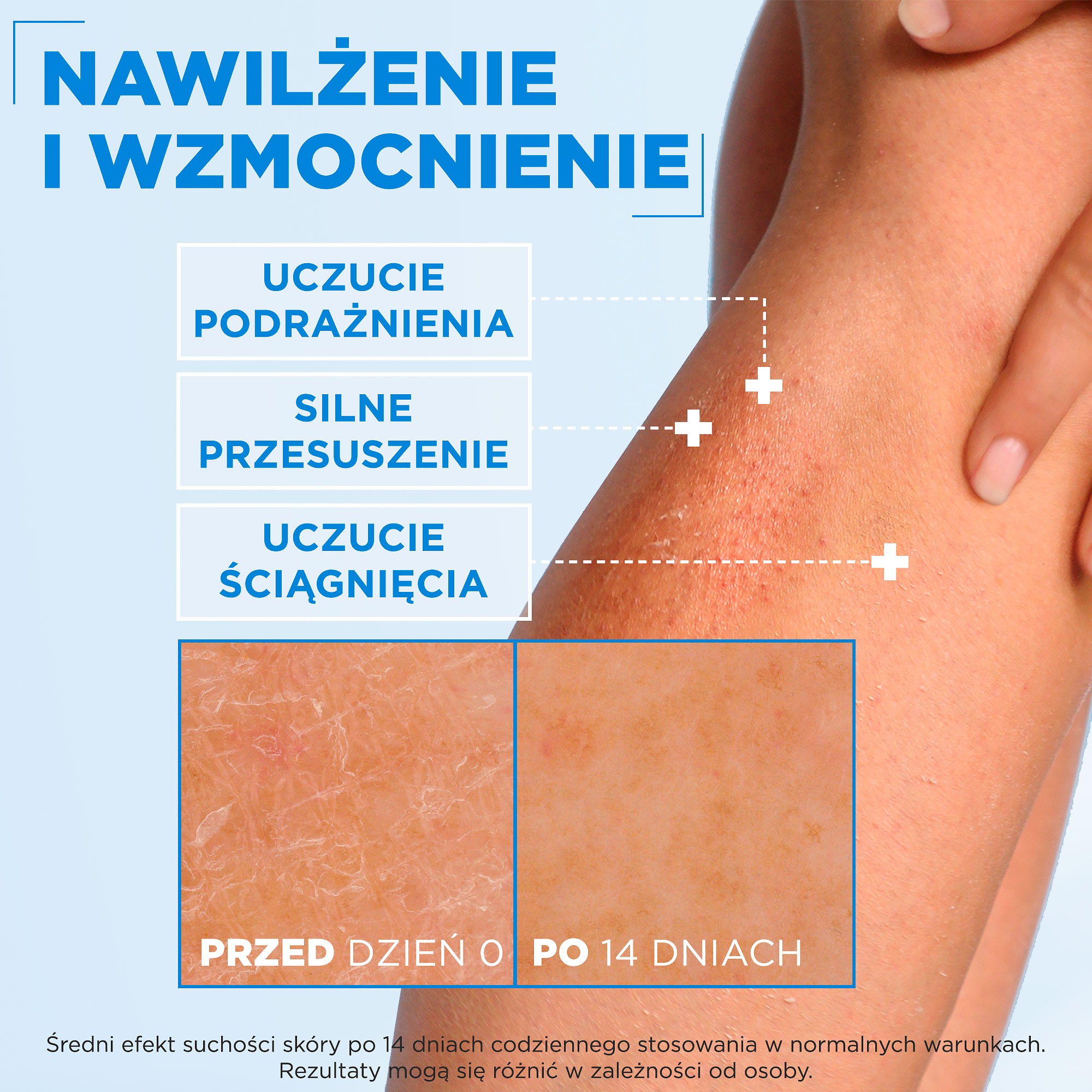 Mixa Ceramide Protect Nawilżający krem ochronny, 400 ml