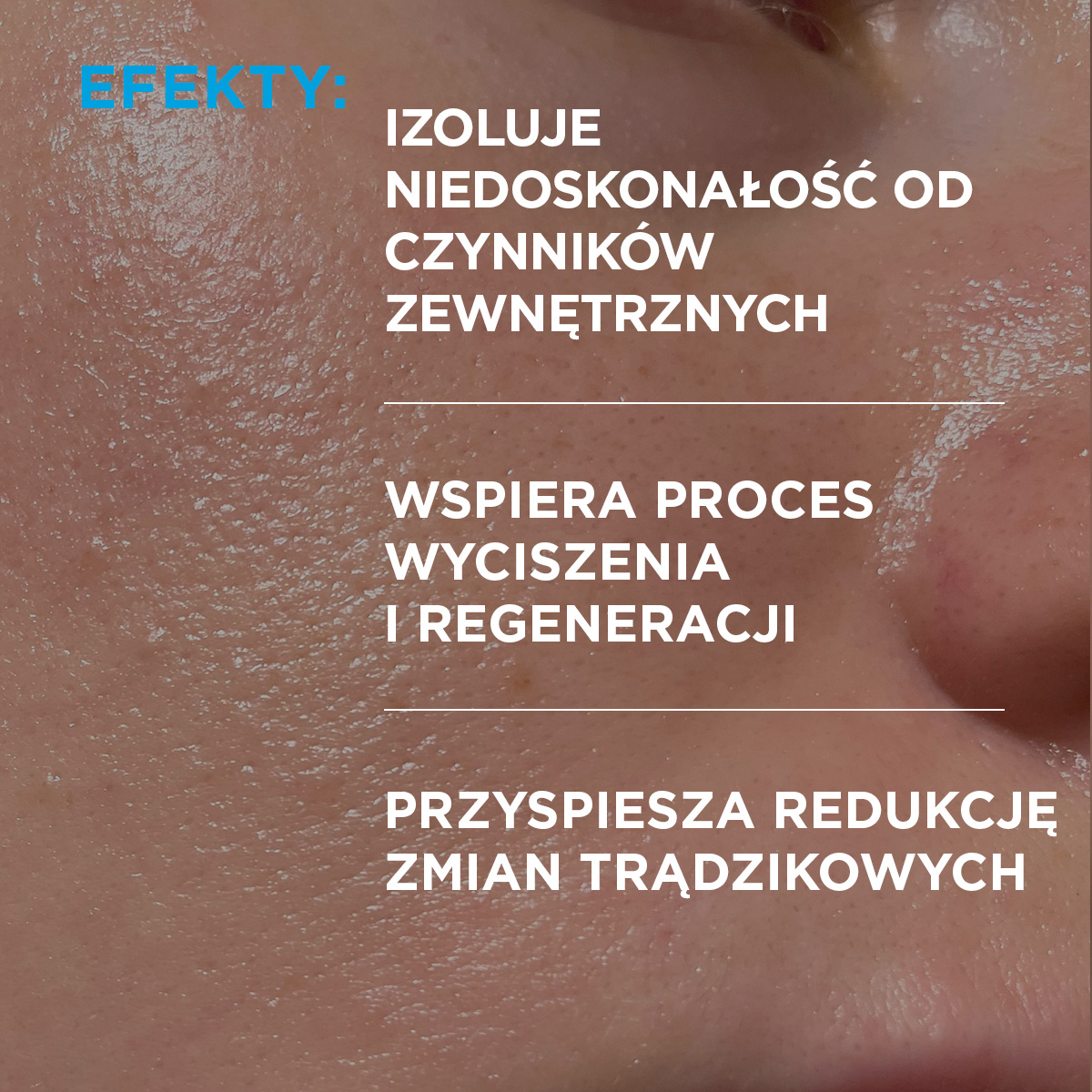 Idee Derm Żel punktowy na wypryski, 15 ml