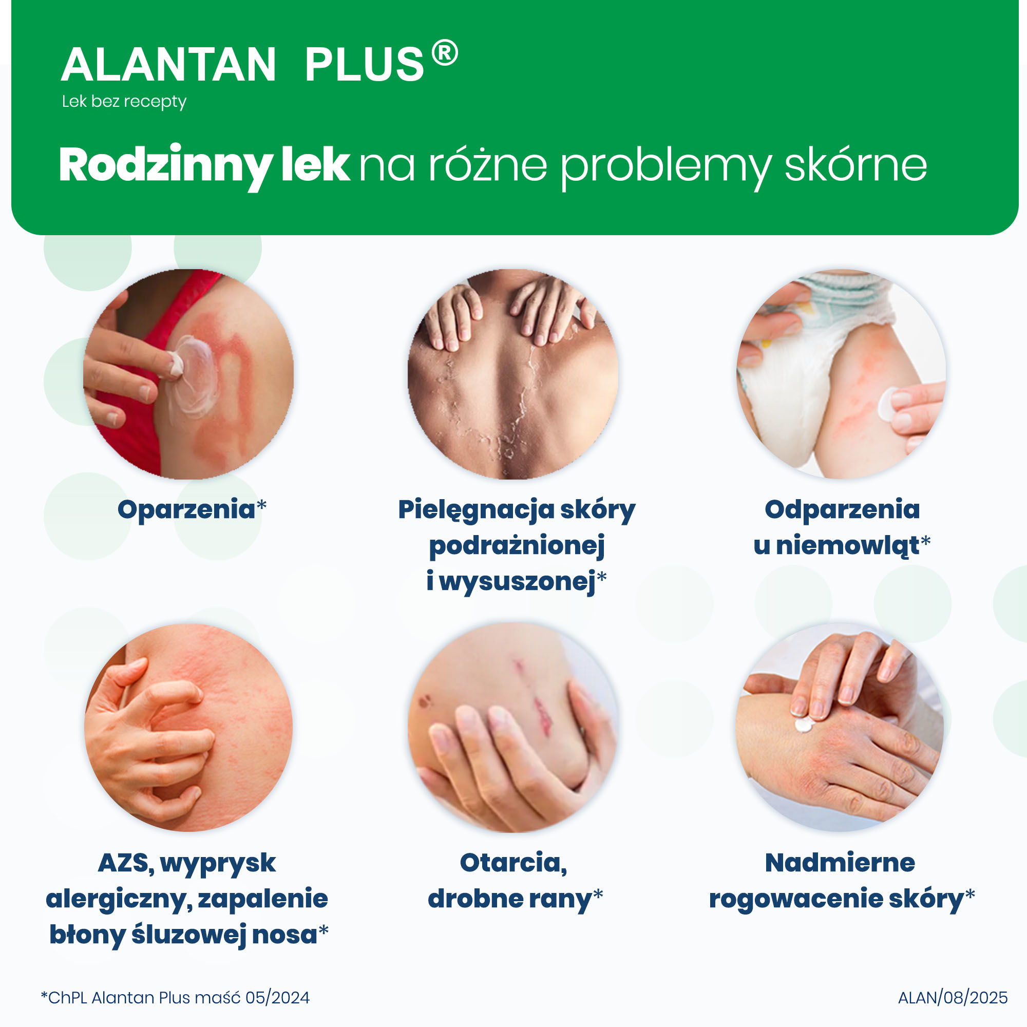 Alantan Plus (20 mg + 50 mg)/g, maść, 30 g