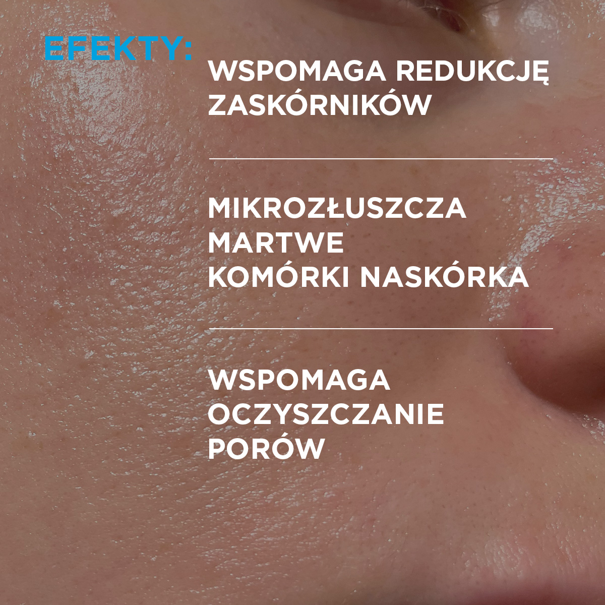 Idee Derm Serum zwalczające trądzik z kwasami, 30 ml