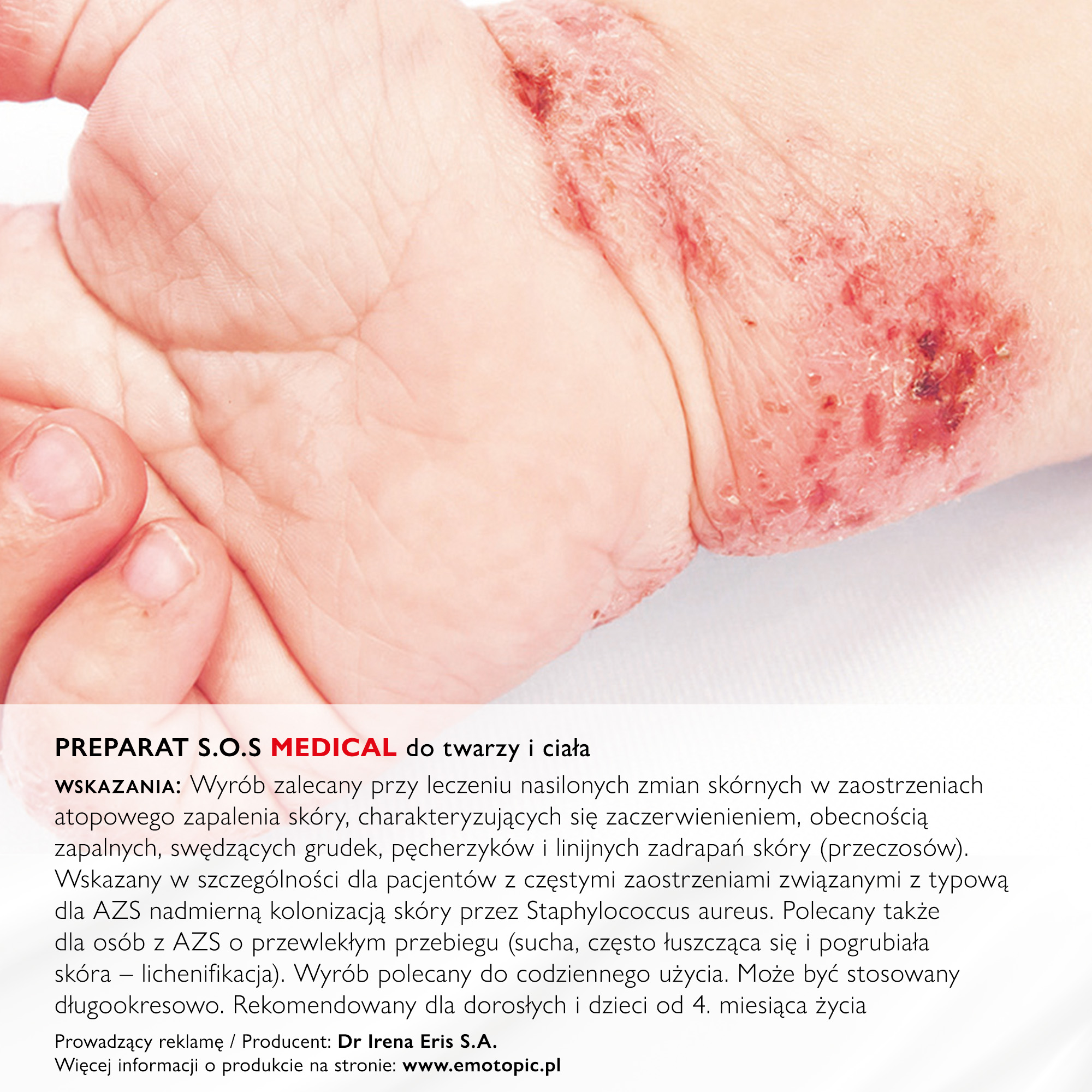 Emotopic Bacteria Control preparat S.O.S Medical do twarzy i ciała 30 ml